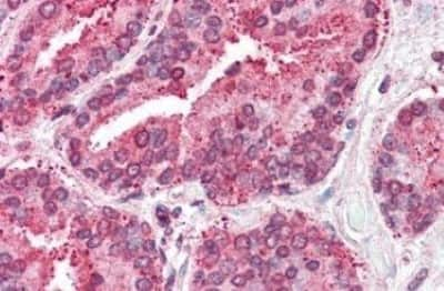 Immunohistochemistry-Paraffin: TSPAN6 Antibody [NBP3-14507]